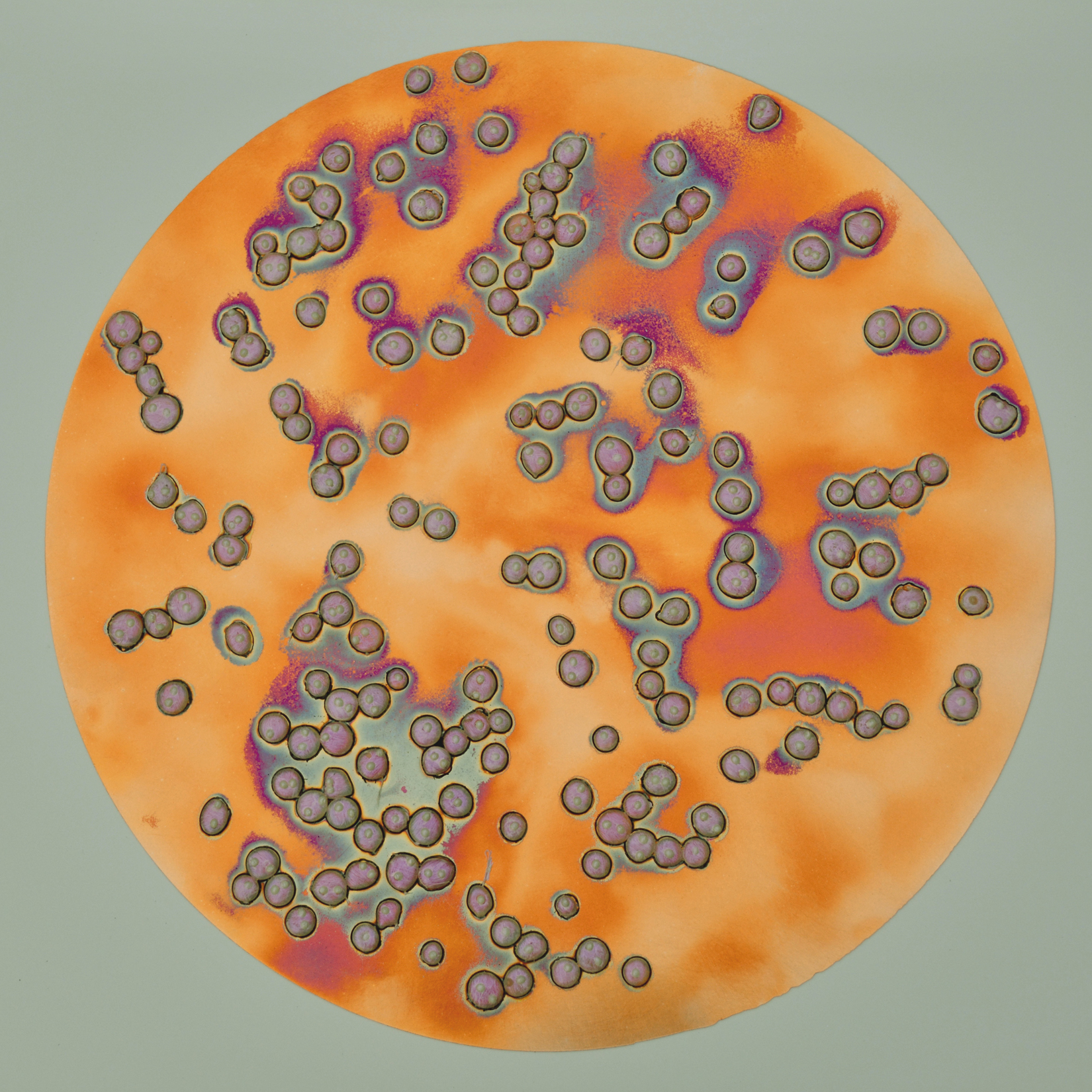 Yeast